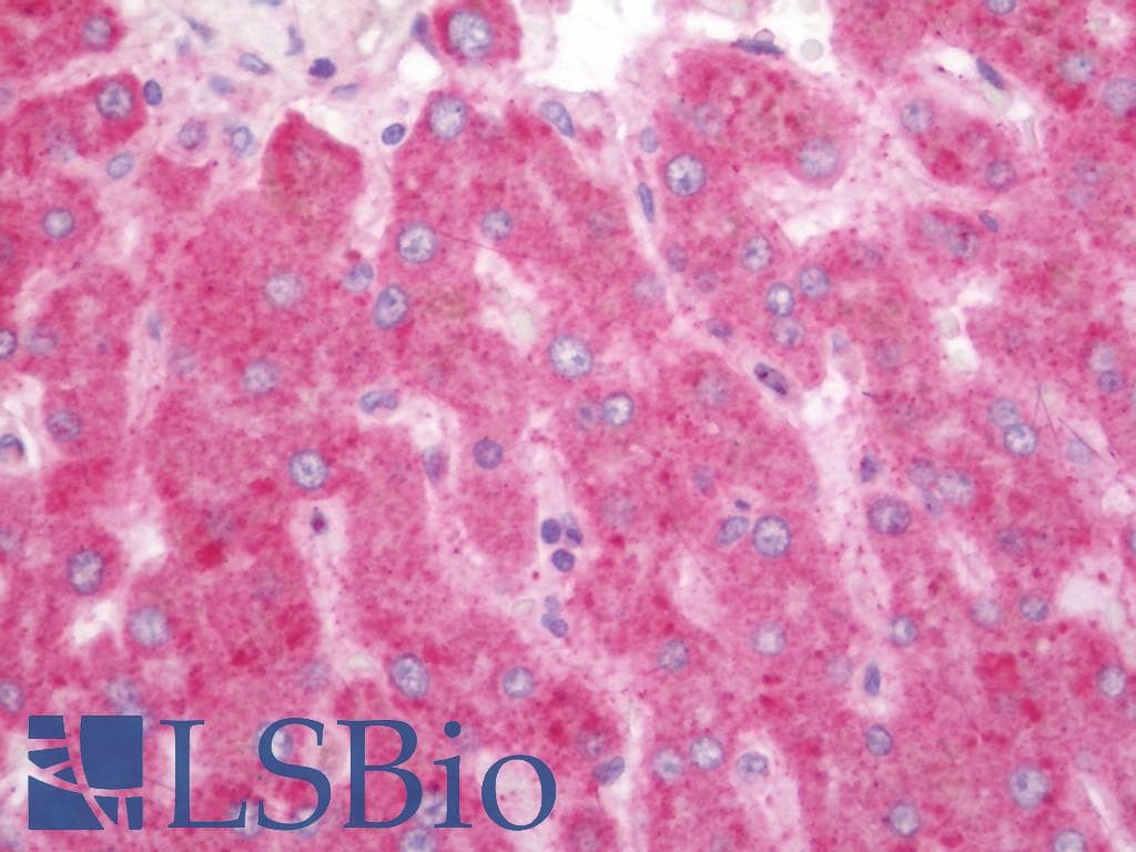 IHC-plus™ Polyclonal Rabbit anti-Human ESCO1 / ECO1 Antibody (aa661-687, IHC, WB)