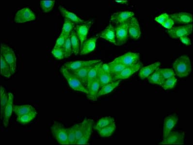 CHKB / CHKL Antibody