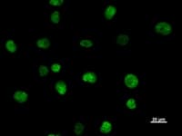 SATB2 Antibody (clone SATBA4B10)