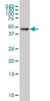 IHC-plus™ RARA / RAR Alpha Antibody (clone 2D2)