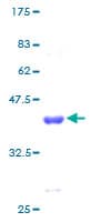 Human HOPX / HOP Protein (Recombinant GST)