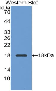 Adiponectin Antibody (aa103-240)