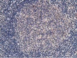 KCTD14 Antibody (clone OTI1D11)