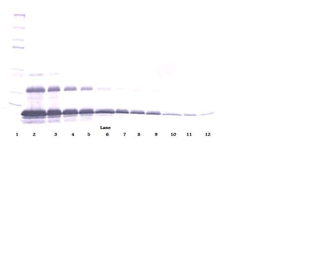 TNFRSF1A / TNFR1 Antibody