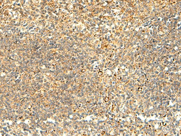 Polyclonal Rabbit anti-Human NAPRT Antibody (IHC)