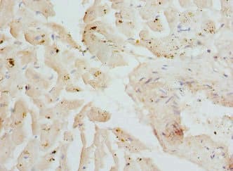 CSRP3 Antibody