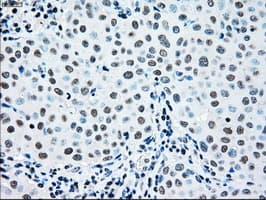 MAP2K2 / MKK2 / MEK2 Antibody (clone OTI5F6)