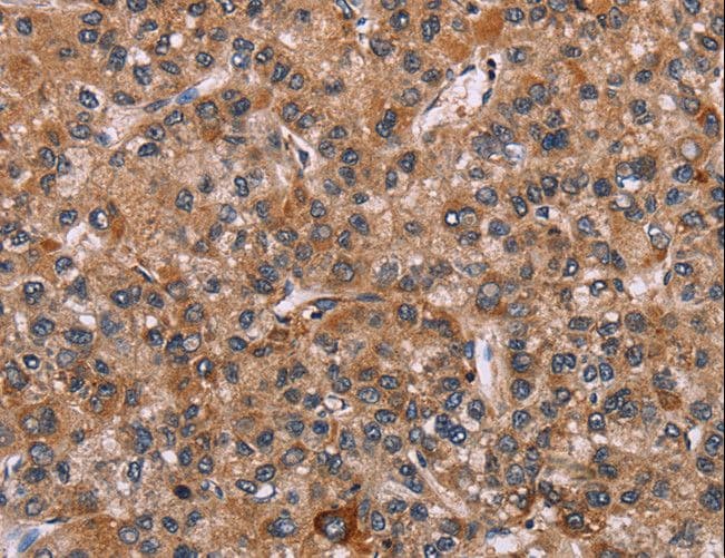 EGR4 / EGR-4 Antibody