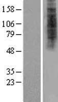 HDX Protein (Over-Expression Lysate Myc-DDK (Flag))