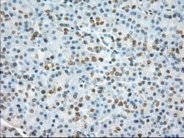 ERIC-1 / TACC3 Antibody (clone OTI6C6)
