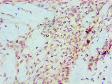 TP53 / p53 Antibody (clone 6H5E7)