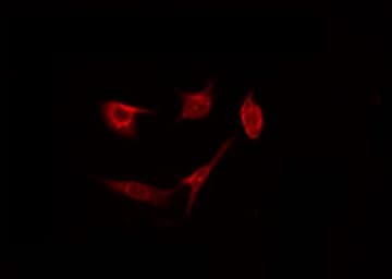 CYP4Z1 Antibody