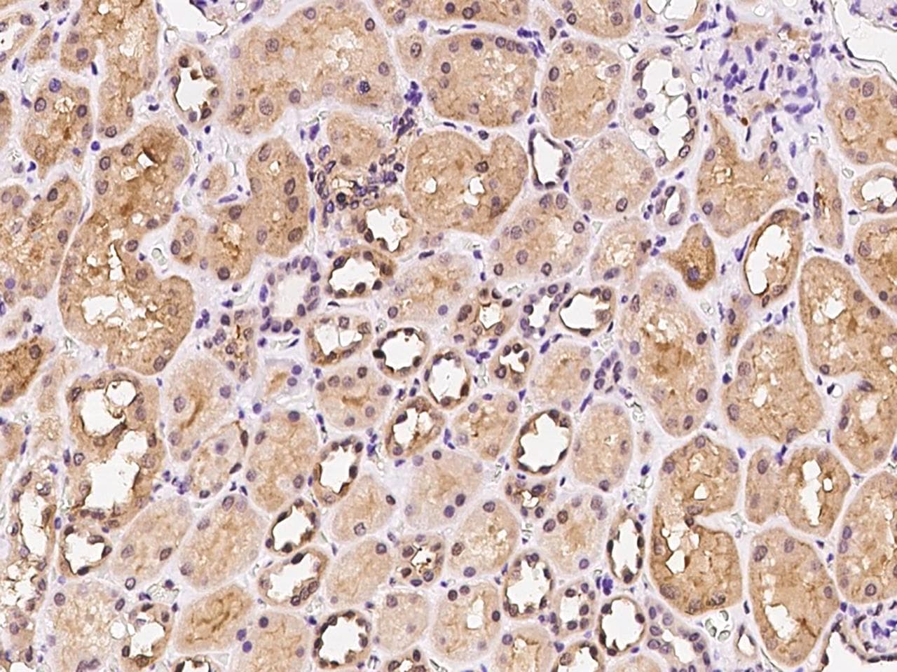 Polyclonal Rabbit anti-Human ARF3 Antibody (IHC)