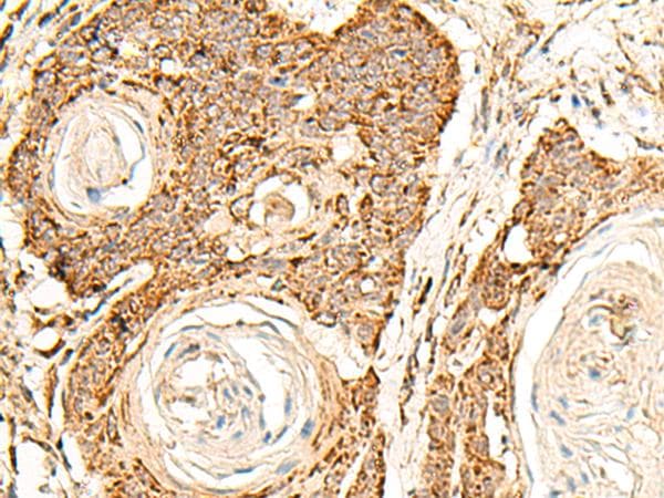 Polyclonal Rabbit anti-Human ATP5I Antibody (IHC, WB)
