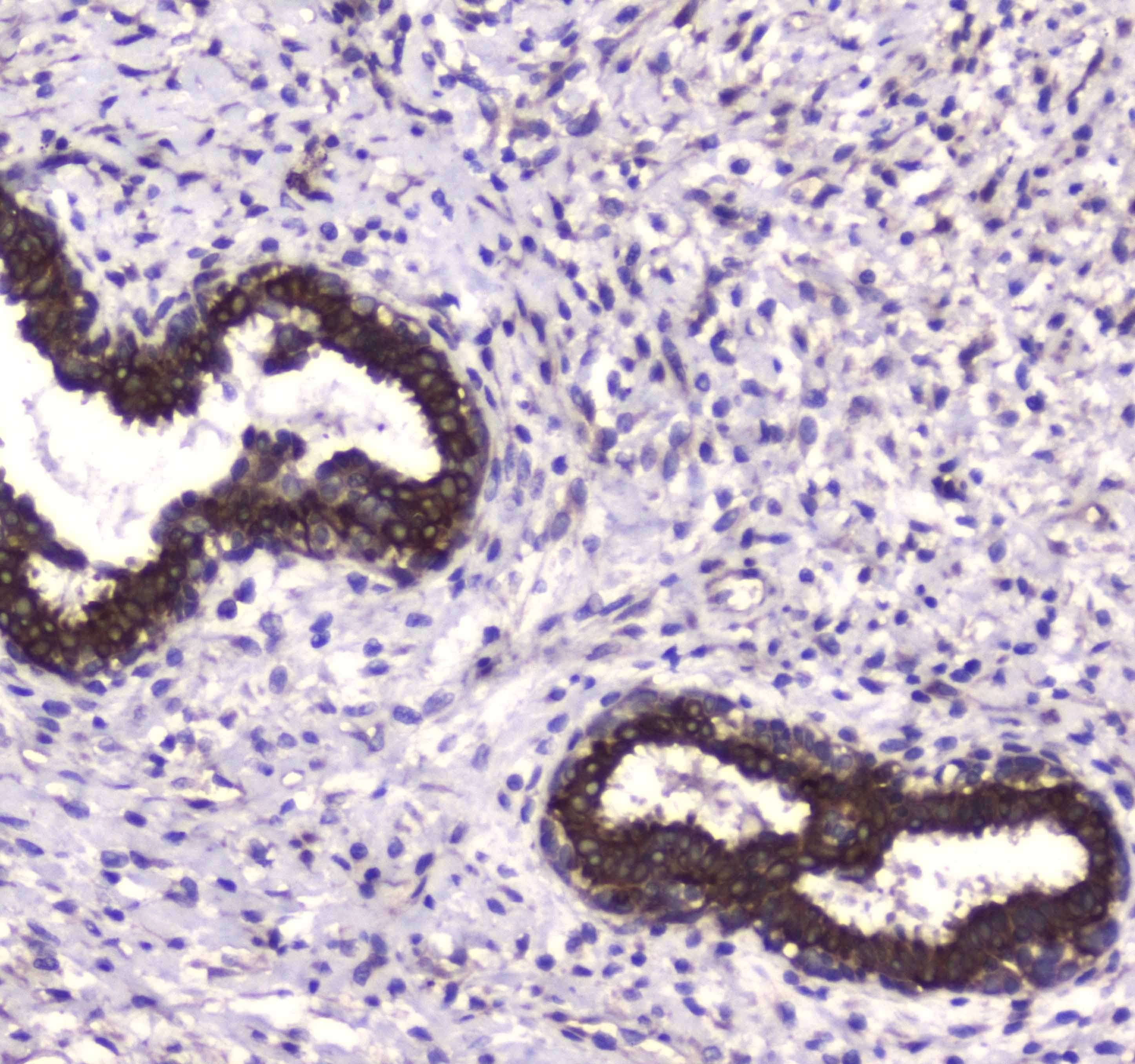 MAP1LC3A / LC3A Antibody