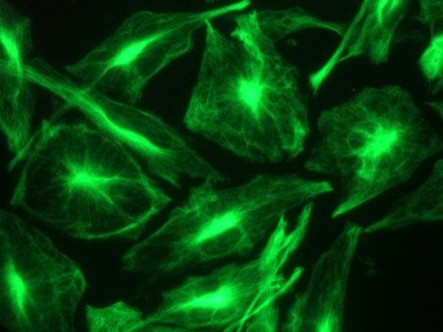 PathPlus™ NES / Nestin Antibody (clone 10C2)