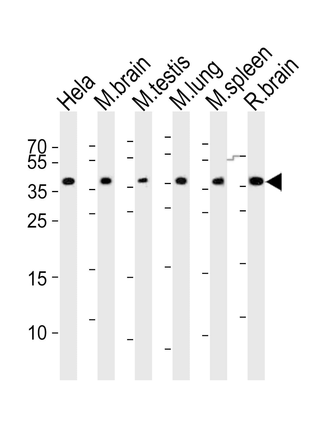 Polyclonal Rabbit anti-Mouse CBX7 Antibody (aa144-178, WB)