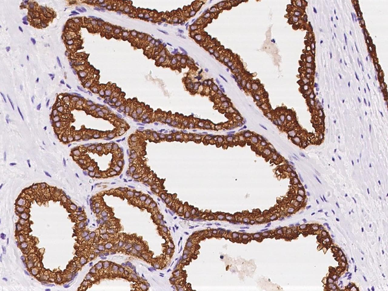 KRT8 / CK8 / Cytokeratin 8 Antibody (Preservative Free)