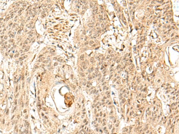 SNAPC5 Antibody