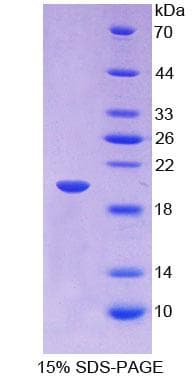 Human IGFBP2 / IGF-BP53 Protein (Recombinant His-T7)