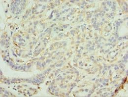 MAGEC2 / CT10 Antibody (aa1-150)