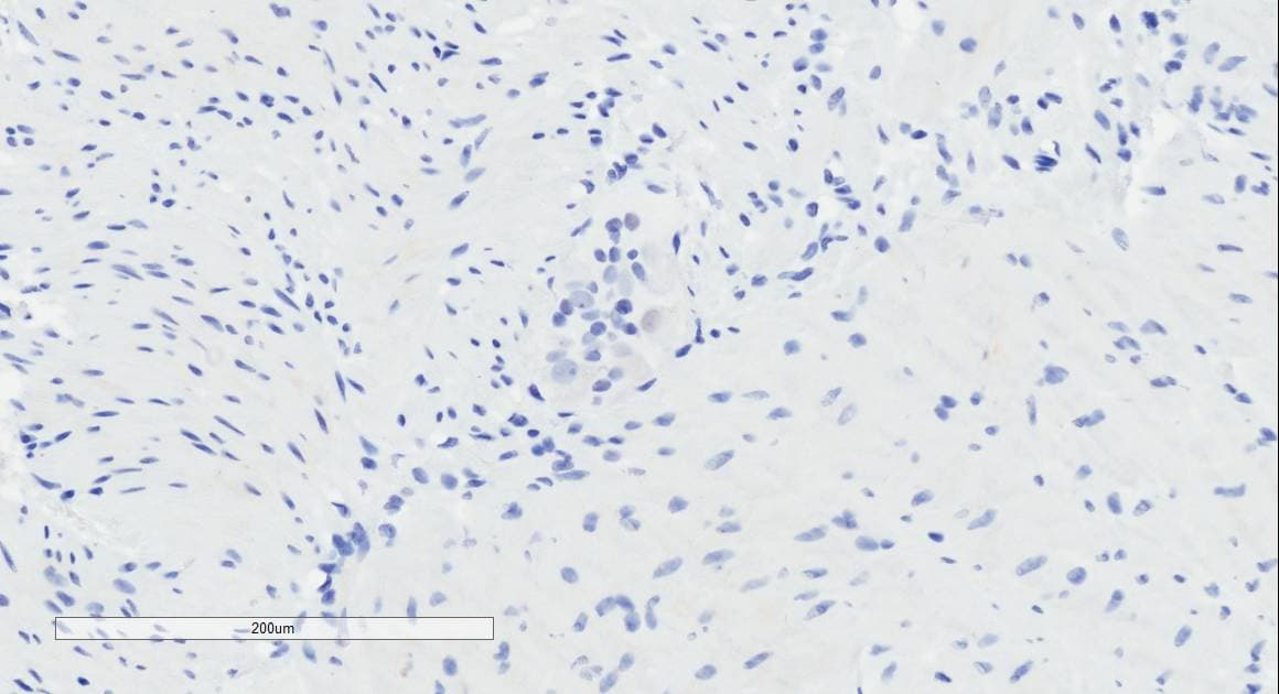O3FAR1 / GPR120 Antibody (aa263-275)