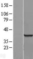 RBMX2 Protein (Over-Expression Lysate Myc-DDK (Flag))