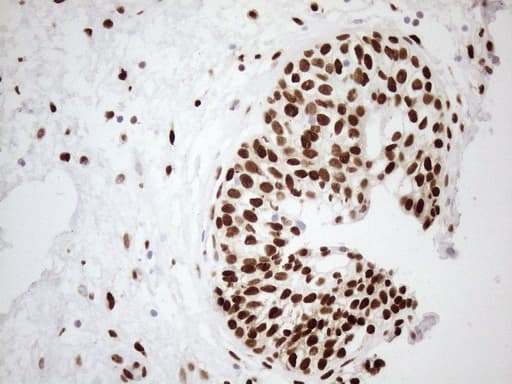 FOS / c-FOS Antibody (clone UMAB221)
