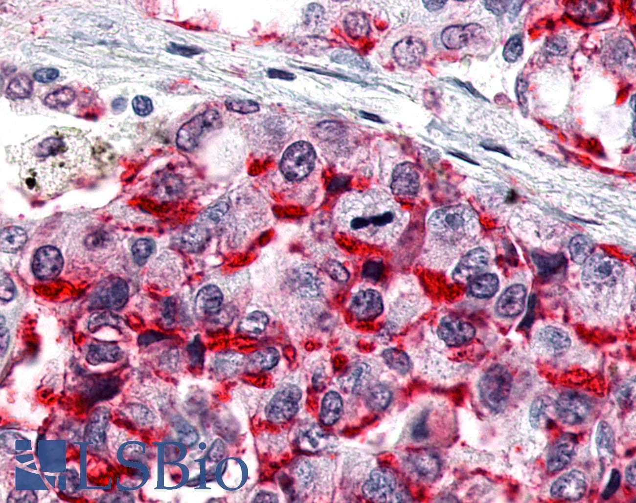 PathPlus™ Polyclonal Rabbit anti-Human ESRRG / ERR Gamma Antibody (C-Terminus, IHC, WB)