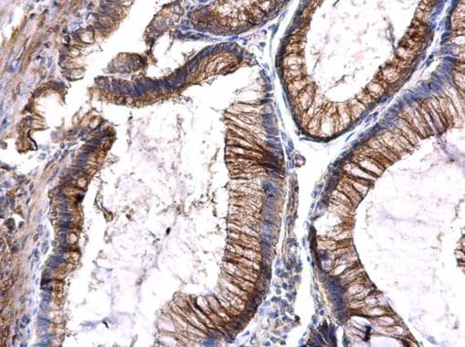 Polyclonal Rabbit anti-Human CD135 / FLT3 Antibody (aa523-784, IHC)