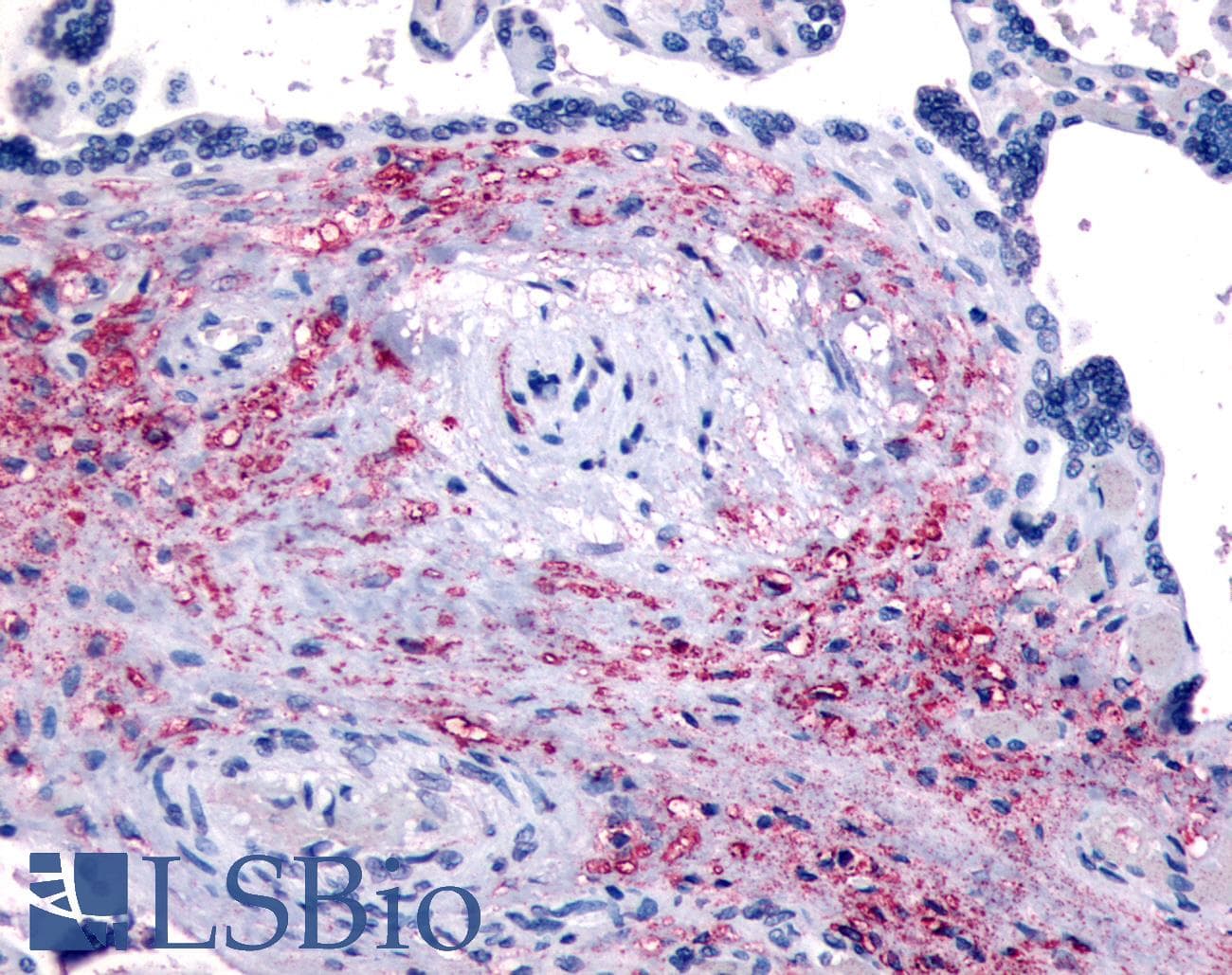 IHC-plus™ NET1 / ARHGEF8 Antibody (Internal)