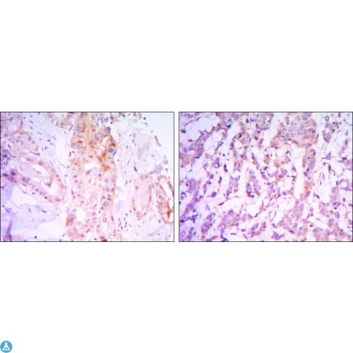 RICTOR Antibody