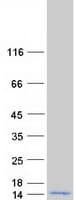 Human UBA52 Protein (Recombinant Myc-DDK (Flag))