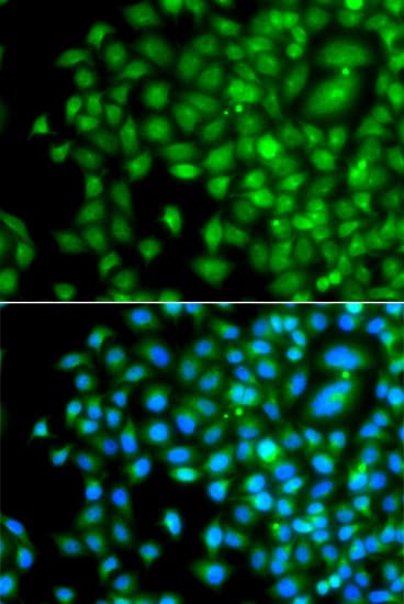 Polyclonal Rabbit anti-Human PAK2 Antibody (IHC, IF, WB)