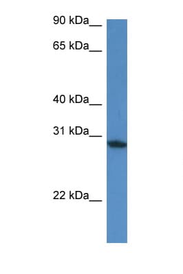 FAM168A Antibody (aa44-93)