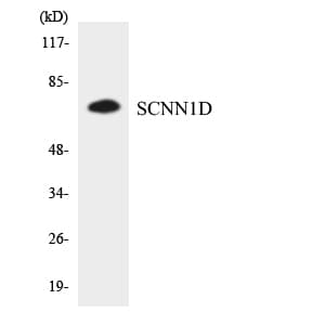 IHC-plus™ SCNN1D Antibody (aa397-446)
