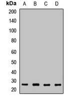 Polyclonal Rabbit anti-Human VPS28 Antibody (WB)