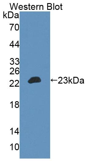 MATK Antibody (aa1-173)