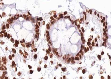 Polyclonal Rabbit anti-Human RAF1 / RAF Antibody (phospho-Ser296, IHC, IF, WB)