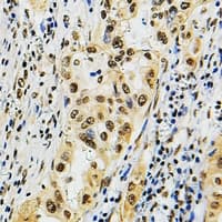 POLR3B Antibody (Internal)