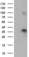 ZFP36 / Tristetraprolin Antibody (clone OTI4B10)