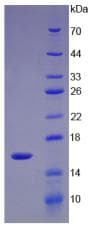 UGCG Protein (Recombinant His)