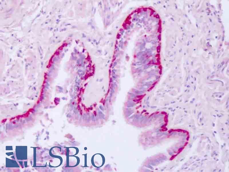 IHC-plus™ Polyclonal Rabbit anti-Human ARFL3 / ARL3 Antibody (aa144-173, IHC, WB)