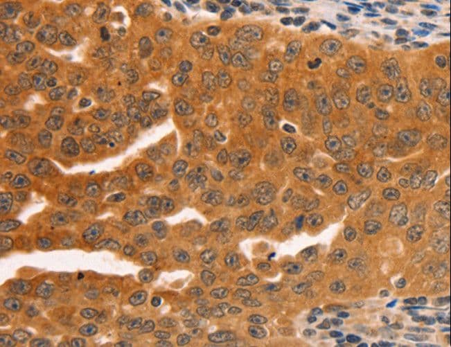 SERPINB5 / Maspin Antibody