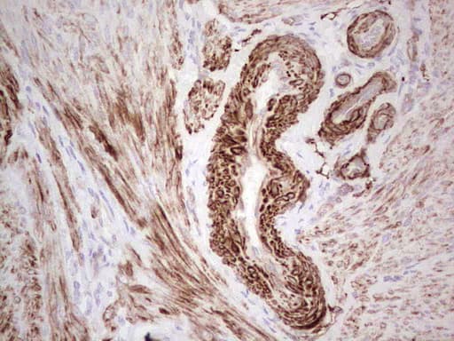 Monoclonal Mouse anti-Human DMN / Desmuslin / Synemin Antibody (clone 2F4, Carrier-free, aa329-580, IHC)