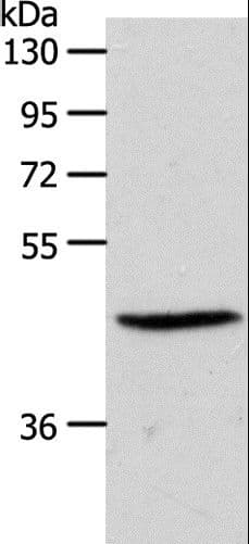 Polyclonal Rabbit anti-Human SIPR3 / EDG3 / S1P3 Antibody (WB)
