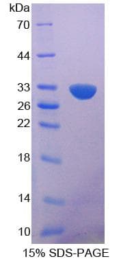 Mouse BMPER Protein (Recombinant His-S)