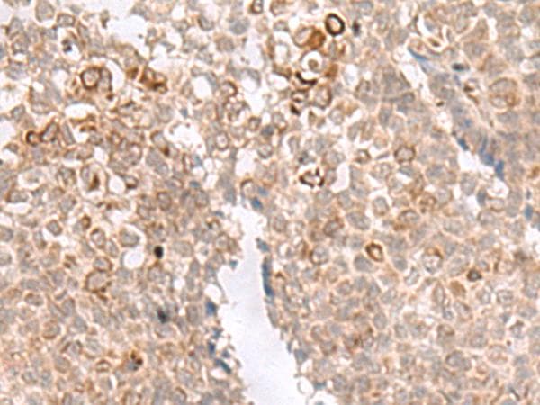 MCAM / CD146 Antibody