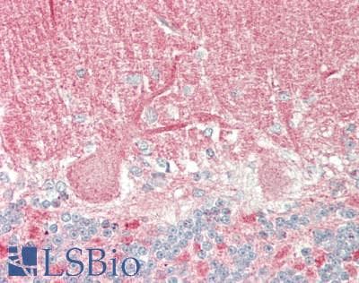 IHC-plus™ CNGA3 Antibody (aa1-165)