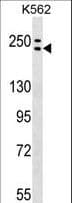 Polyclonal Rabbit anti-Human ADCY9 / Adenylate Cyclase 9 Antibody (aa1295-1323, WB)